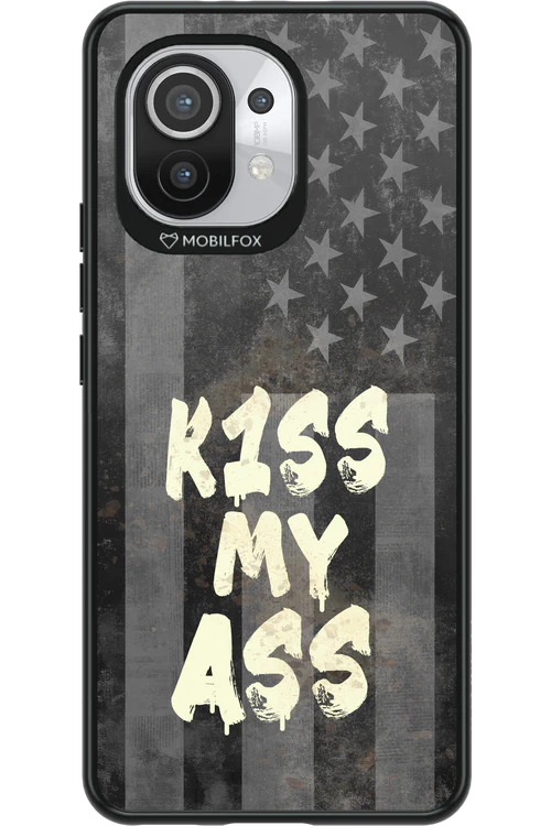 KISS II 2.0 - Xiaomi Mi 11 5G