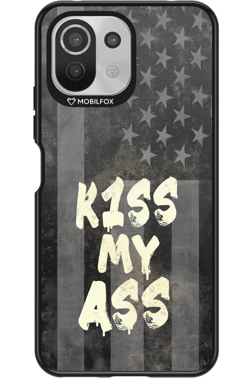 KISS II 2.0 - Xiaomi Mi 11 Lite (2021)