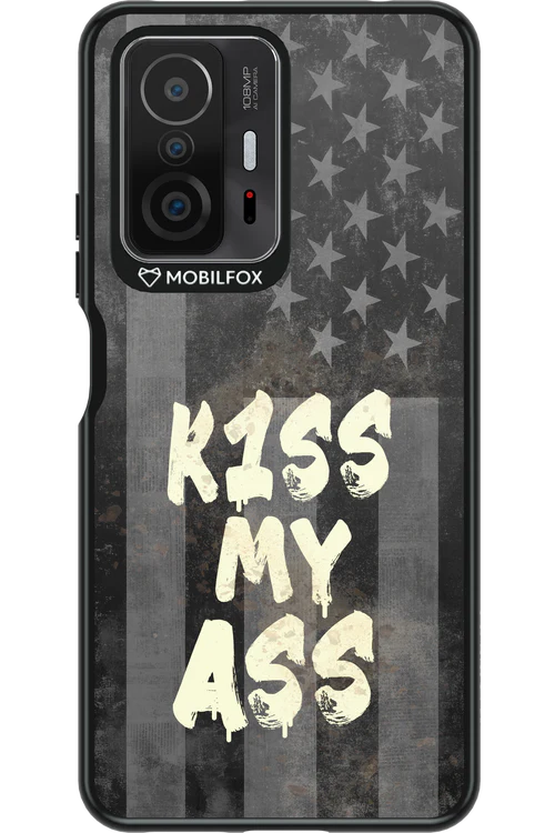 KISS II 2.0 - Xiaomi Mi 11T