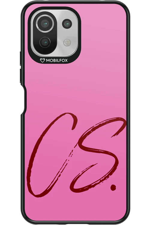 (Sorbet) CS 2.0 - Xiaomi Mi 11 Lite (2021)
