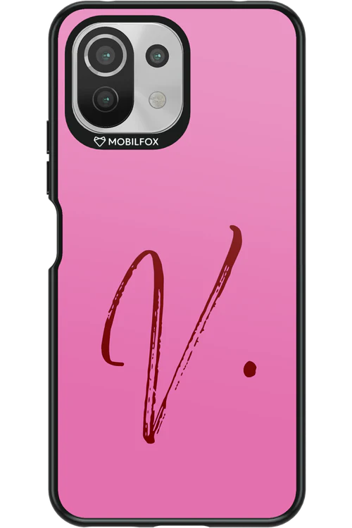 (Sorbet) V 2.0 - Xiaomi Mi 11 Lite (2021)